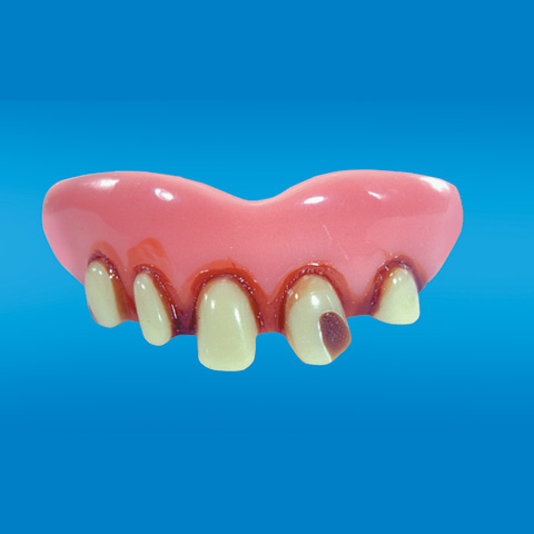 (image for) Billy Bob Teeth - With Cavity
